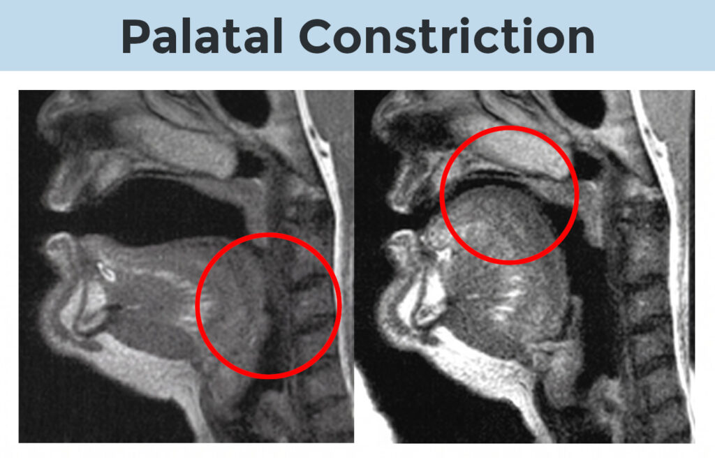 Side-by-side sagittal MRI anatomical profiles showing speech articulation mechanics. Left panel displays the tongue in a relaxed, lower position during the open back vowel sound. Right panel displays high palatal elevation and constriction of the tongue blade towards the hard palate for the close front unrounded vowel sound.