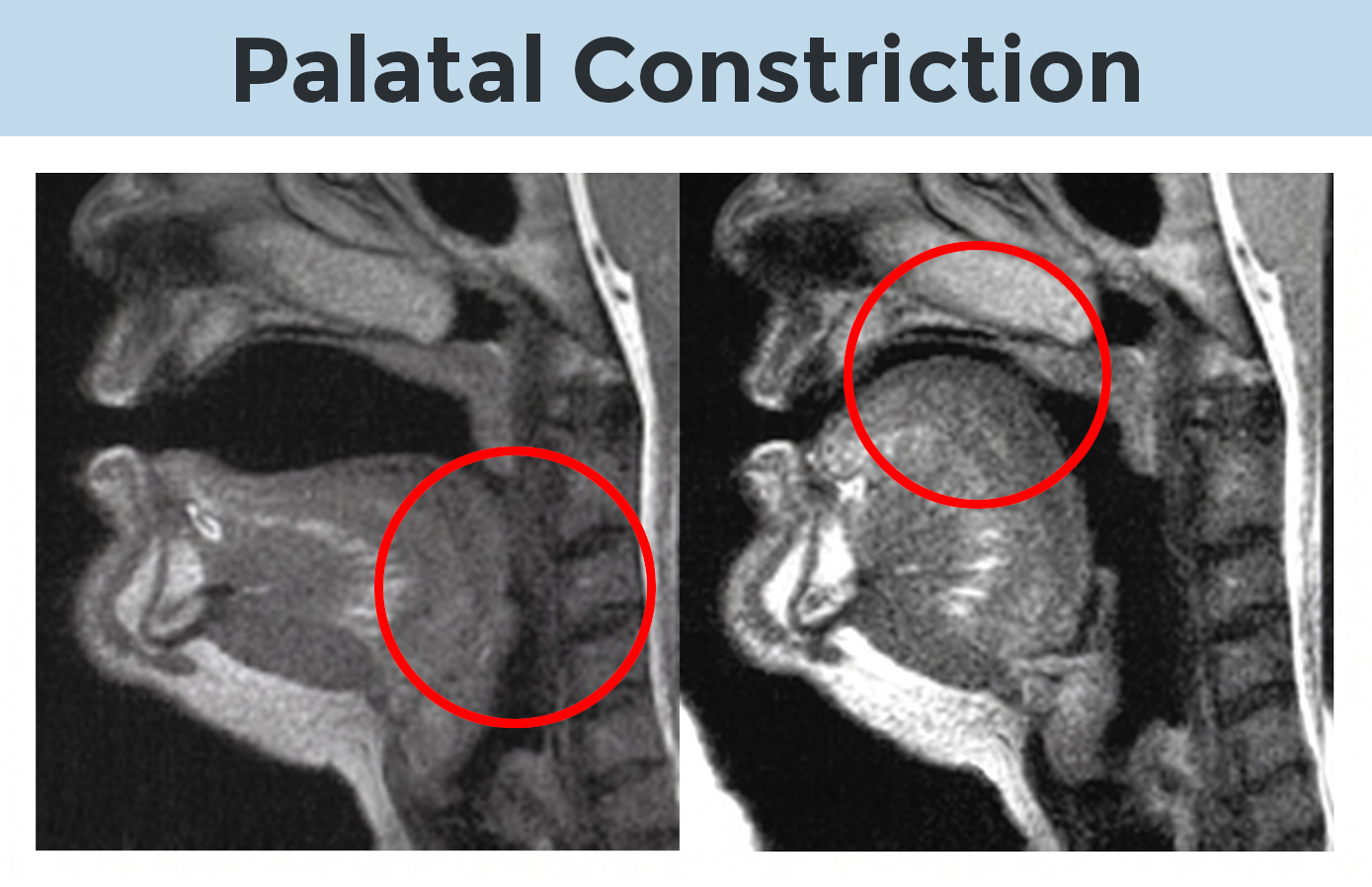 Side-by-side sagittal MRI anatomical profiles showing speech articulation mechanics. Left panel displays the tongue in a relaxed, lower position during the open back vowel sound. Right panel displays high palatal elevation and constriction of the tongue blade towards the hard palate for the close front unrounded vowel sound.
